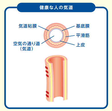 気管支喘息_図1